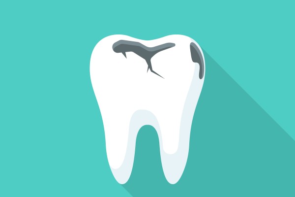 How A Dentist Treats A Loose Dental Filling