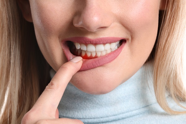 Easy Tips To Prevent Gum Disease