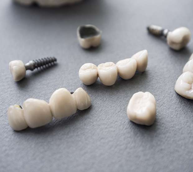 McAllen The Difference Between Dental Implants and Mini Dental Implants